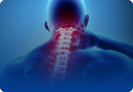 Radiculopatia de Membro Superior